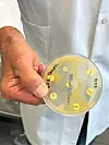 Ved NMBU blir det forska mykje på kva som bit på kva for bakteriar. Her eit petriglas med ei spesifikk bakterie som har fått ulik antibiotika ulike plassar.